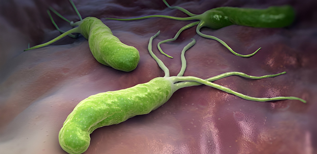 H. Pylori: quando levantar suspeitas?