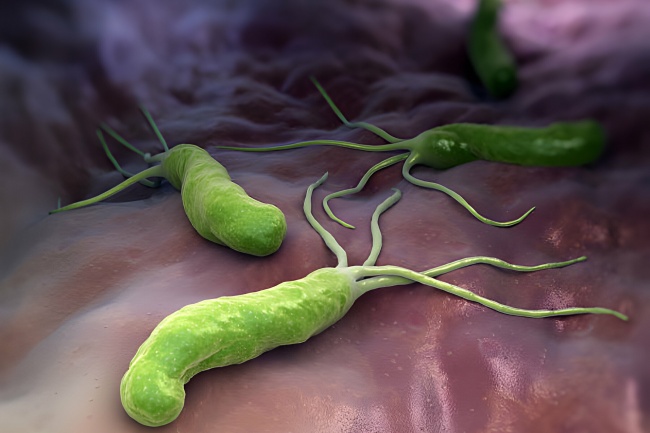 H. Pylori: quando levantar suspeitas?