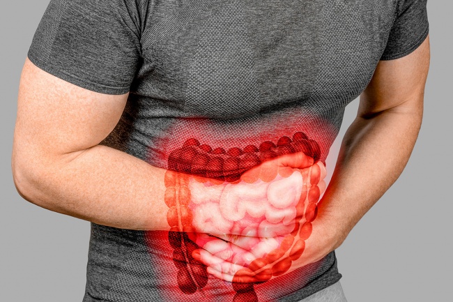 Mesmo sem diarreia, eu posso ter Crohn?