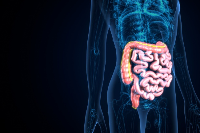 Qual é a diferença entre disbiose e SIBO?