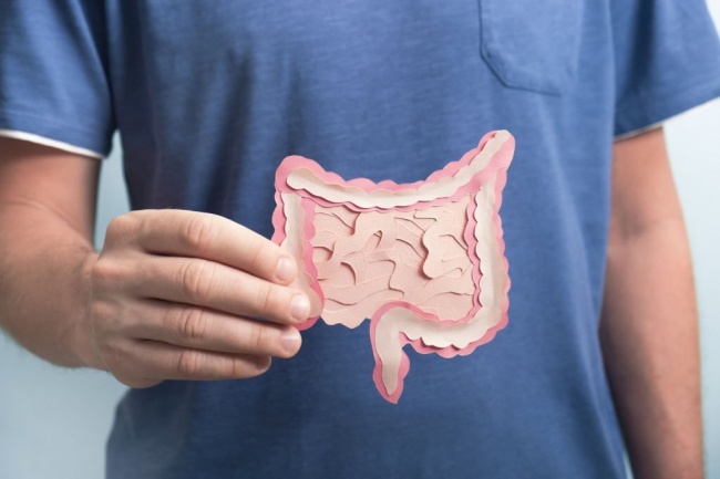 Leaky Gut — Aumento da Permeabilidade Intestinal: já ouviu falar sobre?